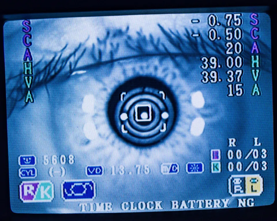 Eye measurement readings on a diagnostic instrument screen